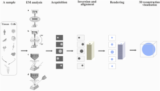 The application and development of electron microscopy for three-dimensional reconstruction in life science: a review.