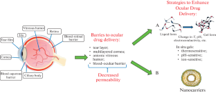 Review of Recent Advances in the Use of Drug Delivery Systems in Ophthalmology