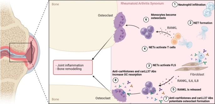 Neutrophils in Inflammatory Bone Diseases.