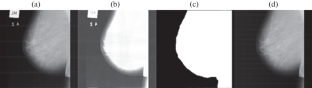 Comparative Analysis of Convolutional Neural Networks for Classification of Breast Abnormalities