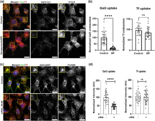 Dynein functions in galectin-3 mediated processes of clathrin-independent endocytosis