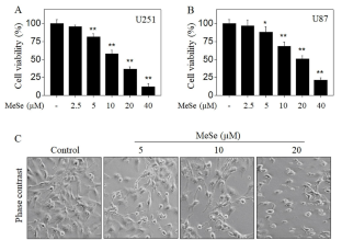 Methylseleninic acid inhibits human glioma growth in vitro and in vivo by triggering ROS-dependent oxidative damage and apoptosis.