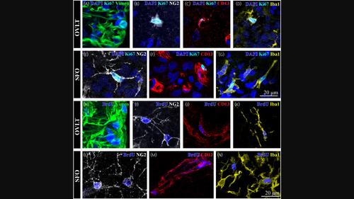 Constitutive cell proliferation and neurogenesis in the organum vasculosum lamina terminalis and subfornical organ of adult rats