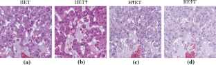 Evaluation of sparsity metrics and evolutionary algorithms applied for normalization of H&E histological images