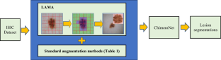 LAMA: Lesion-Aware Mixup Augmentation for Skin Lesion Segmentation.