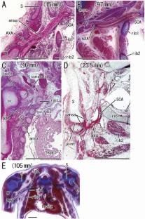 Growth of the brachial nerve plexus with reference to topographical relation of the medianus nerve ansa with the thoracic wall and shoulder: a histologic study using human embryos and fetuses