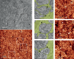 Identification of Ultrastructural Details of the Astrocyte Process System in Nervous Tissue of the Brain Using Correlative Scanning Probe and Transmission Electron Microscopy.