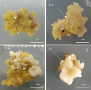 Study on somatic embryogenesis of cinnamomum camphora based on transcriptome sequencing