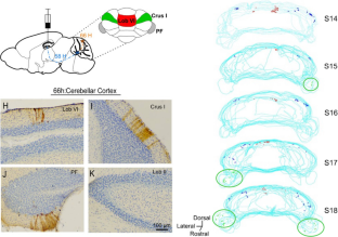 Cerebello-Hippocampal Interactions in the Human Brain: A New Pathway for Insights Into Aging.