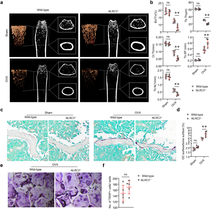 NLRC3 attenuates osteoclastogenesis by limiting TNFα<sup>+</sup> Th17 cell response in osteoporosis.