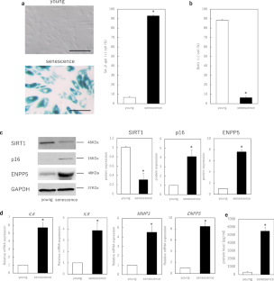 Regulation of ENPP5, a senescence-associated secretory phenotype factor, prevents skin aging.