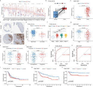 Bioinformatics analysis and experimental validation reveal that CDC20 overexpression promotes bladder cancer progression and potential underlying mechanisms.