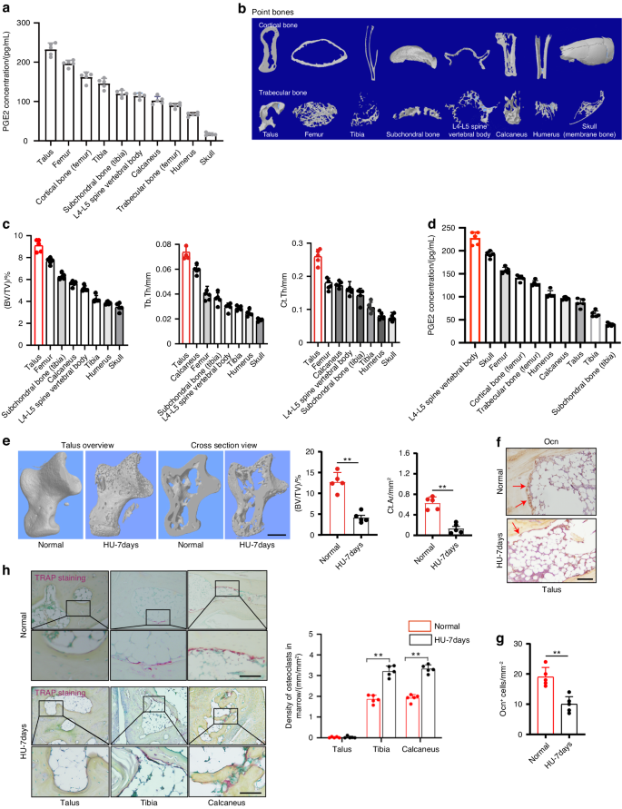 Brain regulates weight bearing bone through PGE2 skeletal interoception: implication of ankle osteoarthritis and pain