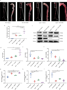 Protective effect of SERCA2a-SUMOylation by SUMO-1 on diabetes-induced atherosclerosis and aortic vascular injury.