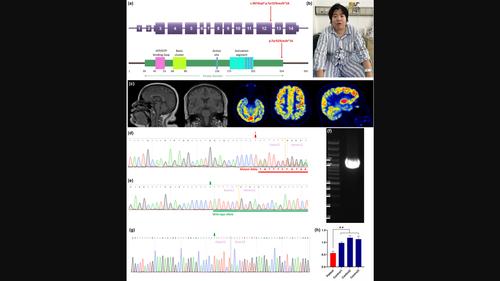 Okur-Chung neurodevelopmental syndrome: Implications for phenotype and genotype expansion.