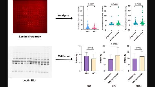 Changes in serum immunoglobulin G glycosylation patterns for antiphospholipid syndrome patients with lectin microarray