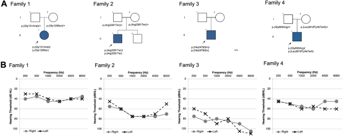 PKHD1L1, a gene involved in the stereocilia coat, causes autosomal recessive nonsyndromic hearing loss.