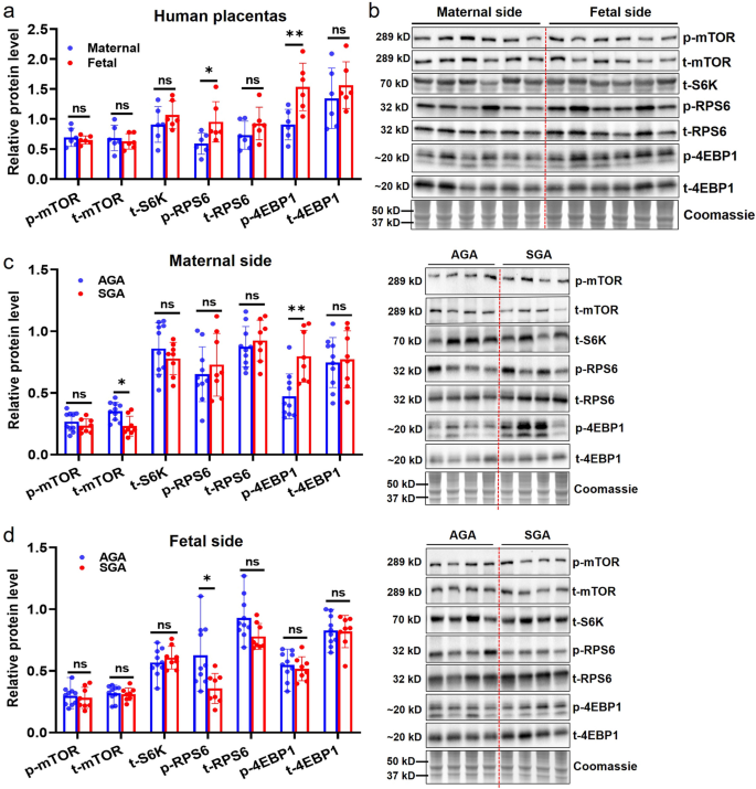 Fetal growth restriction exhibits various mTOR signaling in different regions of mouse placentas with altered lipid metabolism.