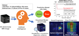 3D CNN-based Deep Learning Model-based Explanatory Prognostication in Patients  with Multiple Myeloma using Whole-body MRI.