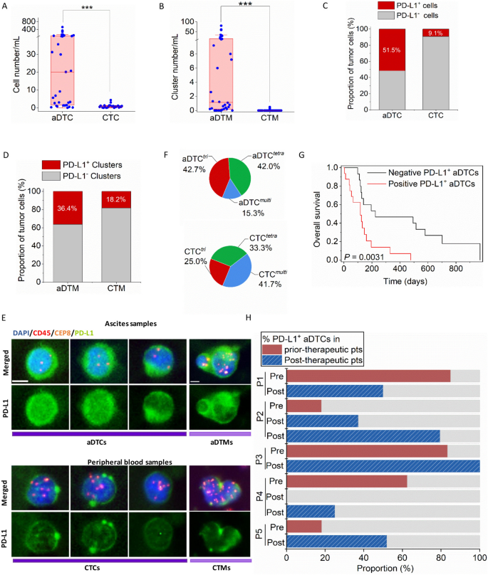 Specific lineage transition of tumor-associated macrophages elicits immune evasion of ascitic tumor cells in gastric cancer with peritoneal metastasis.