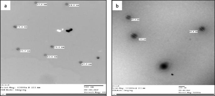 Anti-nemic potential of Laurencia papillosa and Dilophys fasciola biosynthesized nano-extracts against tomato root-knot nematode Meloidogyne incognita