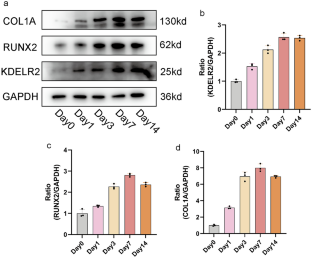 KDELR2 promotes bone marrow mesenchymal stem cell osteogenic differentiation via GSK3β/β-catenin signaling pathway.