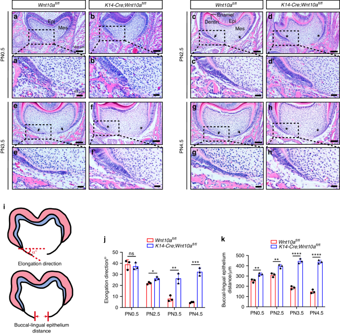 A Wnt10a-Notch signaling axis controls Hertwig's epithelial root sheath cell behaviors during root furcation patterning.