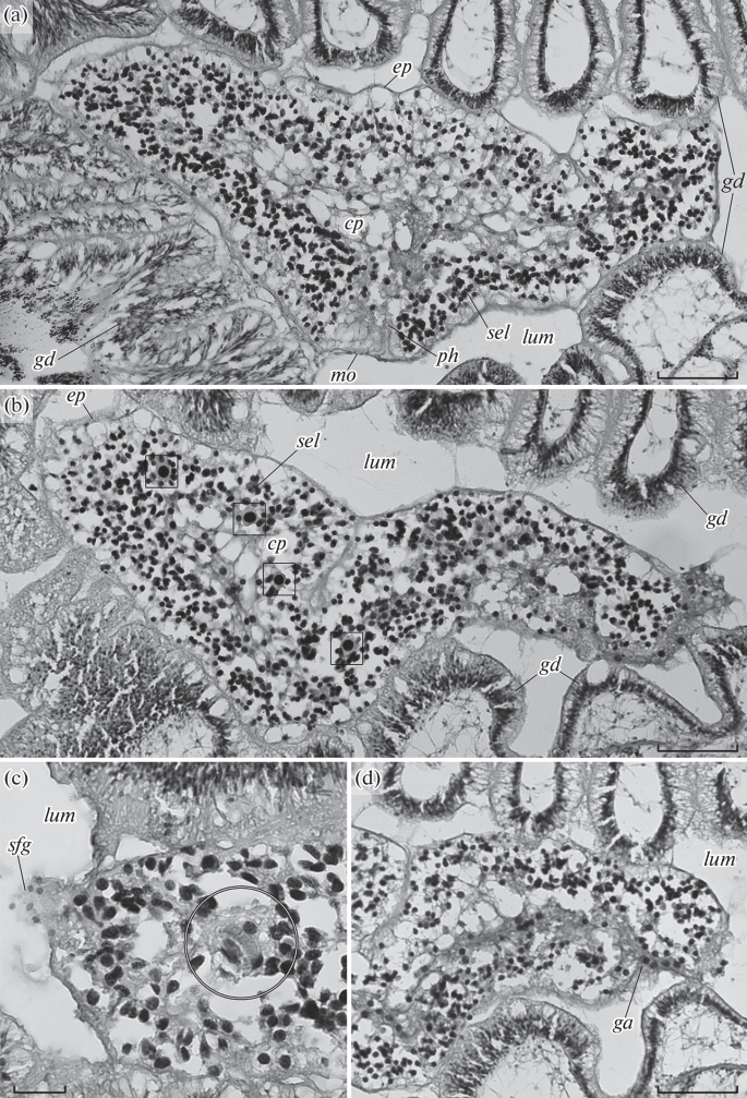 Nemertodermatida-Endosymbionts of Deep-Sea Acorn Worms (Hemichordata, Torquaratoridae).