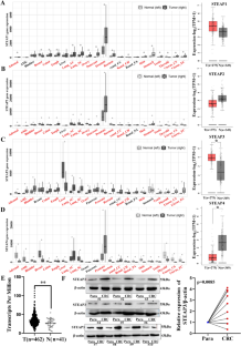 STEAP3 promotes colon cancer cell proliferation and migration via regulating histone acetylation.