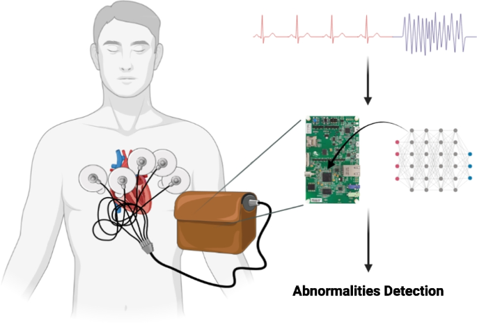 Efficient Edge-AI Models for Robust ECG Abnormality Detection on Resource-Constrained Hardware.