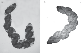 Decalcification of a Clam Shell Caused by Trematodes: Side Effect or Manipulation of the Host Phenotype?