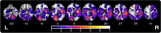 Hayling and stroop tests tap dissociable deficits and network-level neural correlates.