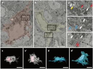 Regional differences in the ultrastructure of mucosal macrophages in the rat large intestine.