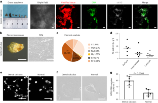 Bacteria-mediated resistance of neutrophil extracellular traps to enzymatic degradation drives the formation of dental calculi