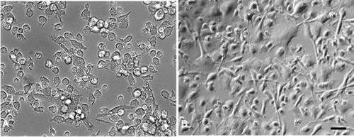 Deoxynivalenol triggers the expression of IL-8-related signaling cascades and decreases protein biosynthesis in primary monocyte-derived cells