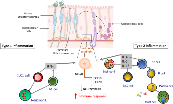 Type 2 and Non-type 2 Inflammation in the Upper Airways: Cellular and Molecular Alterations in Olfactory Neuroepithelium Cell Populations.