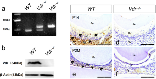 The role of vitamin D receptor in predentin mineralization and dental repair after injury.