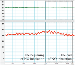 What Is the Reason that Gaseous Nitric Oxide Inhalation Does Not Affect Systemic Arterial Pressure in Humans and Animals?