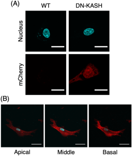 A homeostatic role of nucleus-actin filament coupling in the regulation of cellular traction forces in fibroblasts