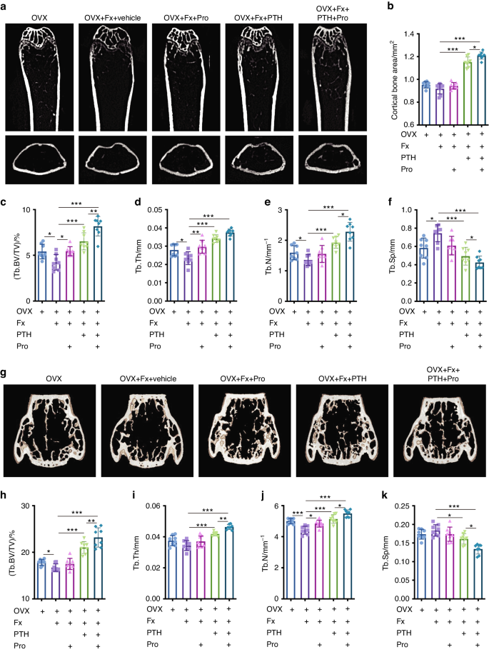 β-Receptor blocker enhances the anabolic effect of PTH after osteoporotic fracture