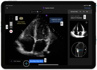 Leveraging the Capabilities of AI: Novice Neurology-Trained Operators Performing Cardiac POCUS in Patients with Acute Brain Injury.