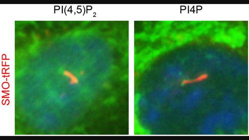 INPP5E Regulates the Distribution of Phospholipids on Cilia in RPE1 Cells