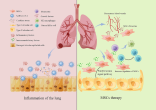 Challenges of mesenchymal stem cells in the clinical treatment of COVID-19.