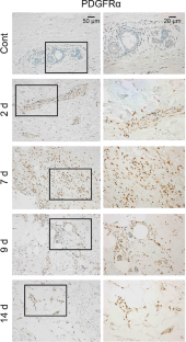 Immunohistochemical analysis of PDGFR-α for wound age determination.