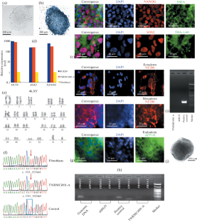 Generation of an Induced Pluripotent Stem Cell Line TNRMCi001-A by Reprogramming Fibroblasts from a Homozygous F508del Cystic Fibrosis Patient