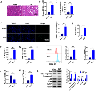 WTAP-mediated N6-methyladenosine modification promotes the inflammation, mitochondrial damage and ferroptosis of kidney tubular epithelial cells in acute kidney injury by regulating LMNB1 expression and activating NF-κB and JAK2/STAT3 pathways.