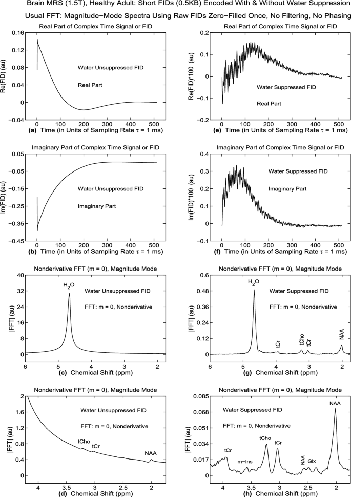 In vivo brain MRS at a 1.5T clinical scanner: Optimized derivative fast Fourier transform for high-resolution spectra from time signals encoded with and without water suppression