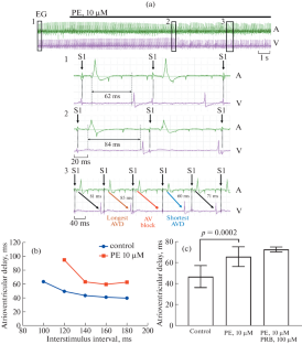 The Influence of Probenecid on the Proarrhythmic Effects of the Activation of α-1-adrenoceptor in the Atrioventricular Node of the Rat Heart