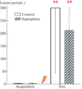 The Effect of Surgical Procedure in the Nasal Cavity on the Passive Avoidance Conditioning and the Hypothalamic Level of Monoamines in Rats.