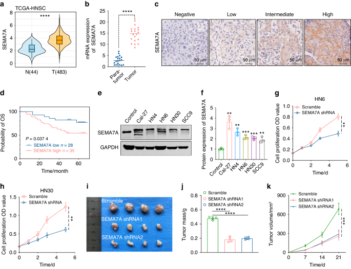 FUT8-mediated aberrant N-glycosylation of SEMA7A promotes head and neck squamous cell carcinoma progression